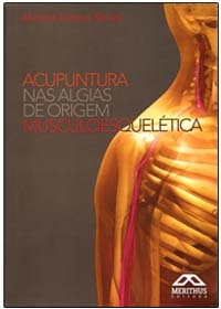 Acupuntura nas Algias de Origem Musculoesqueléticaog:image